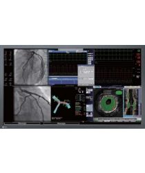 Operāciju zāles monitori Eizo