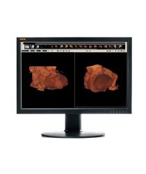 WIDE CL24s radioloģijas monitors