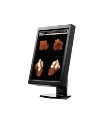 WIDE CX20N radioloģijas monitors