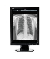 WIDE MX50N radioloģijas monitors