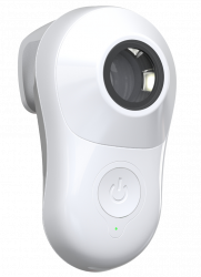 Dermatoskops MoleScope