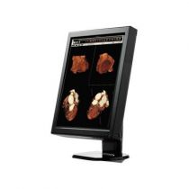 WIDE CX20N radioloģijas monitors